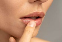 ترک خوردن لب به علت کمبود این ویتامین در بدن است!