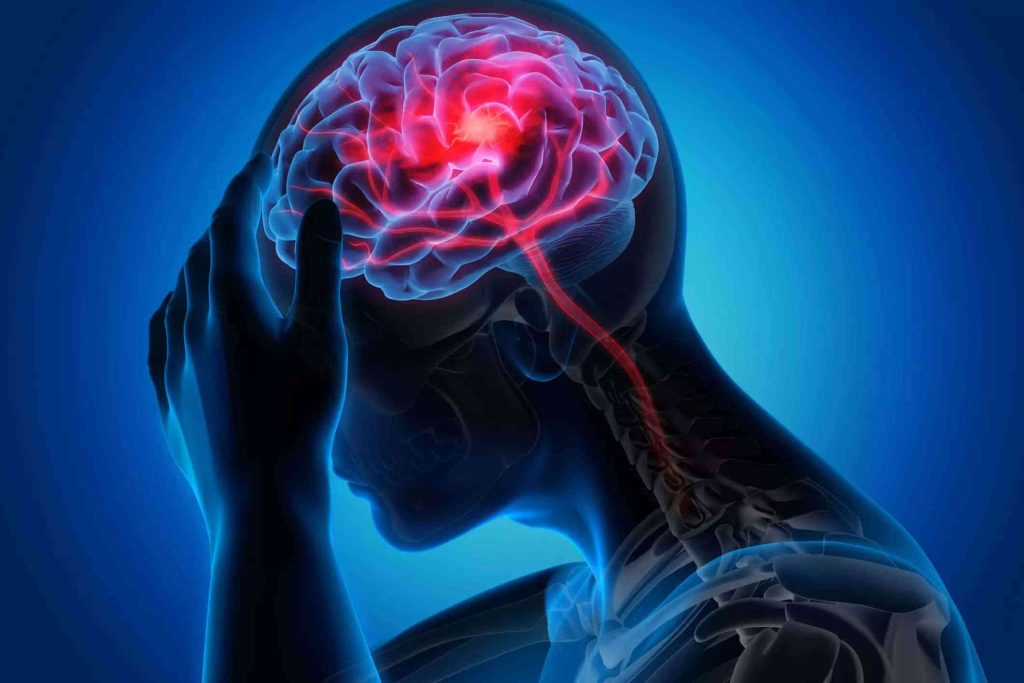 علائم سکته مغزی