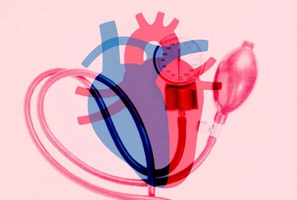 جلوگیری از سکته قلبی