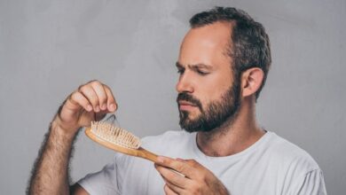 درمان ریزش موی شقیقه