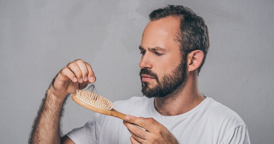 درمان ریزش موی شقیقه