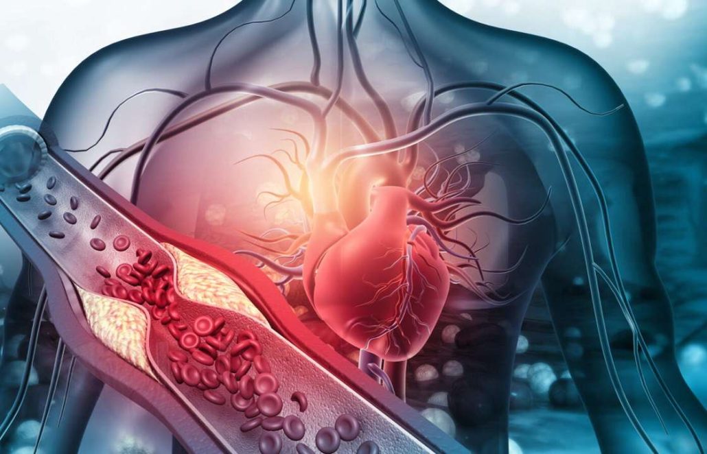 گرفتگی عروق بدن خود را با 3 تست خانگی شناسایی کنید