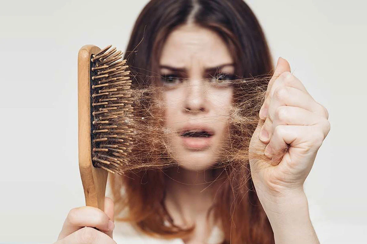 تفاوت ریزش مو ارثی و هورمونی