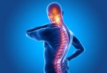 علائم روماتیسم ستون فقرات