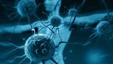 تاثیر باورنکردنی نخندیدن و کم خوابی در ضعیف‌ شدن سیستم ایمنی بدن