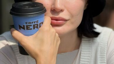 واکنش شیوا طاهری به شایعات عمل زیبایی اش